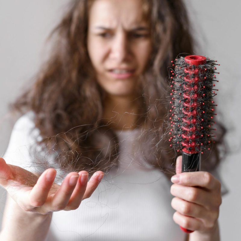 Conociendo los Diferentes Tipos de Alopecia: Causas y Características
