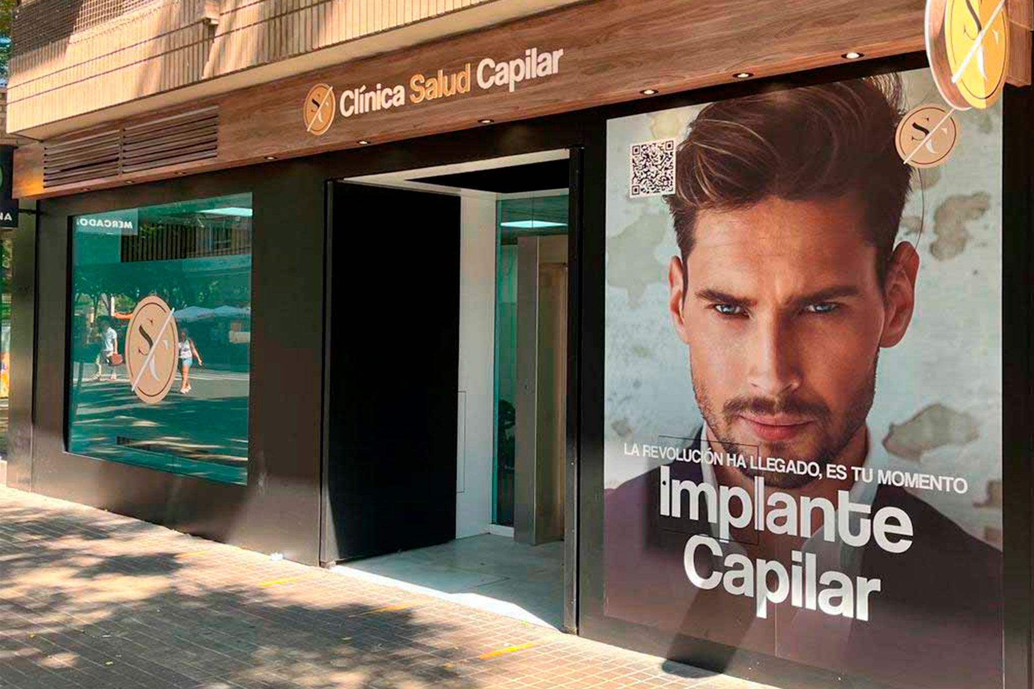 Soluciones para el trasplante capilar en Clínica Salud Capilar