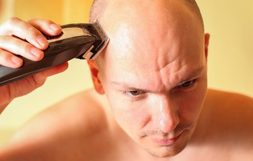 injerto pelo sin rapar