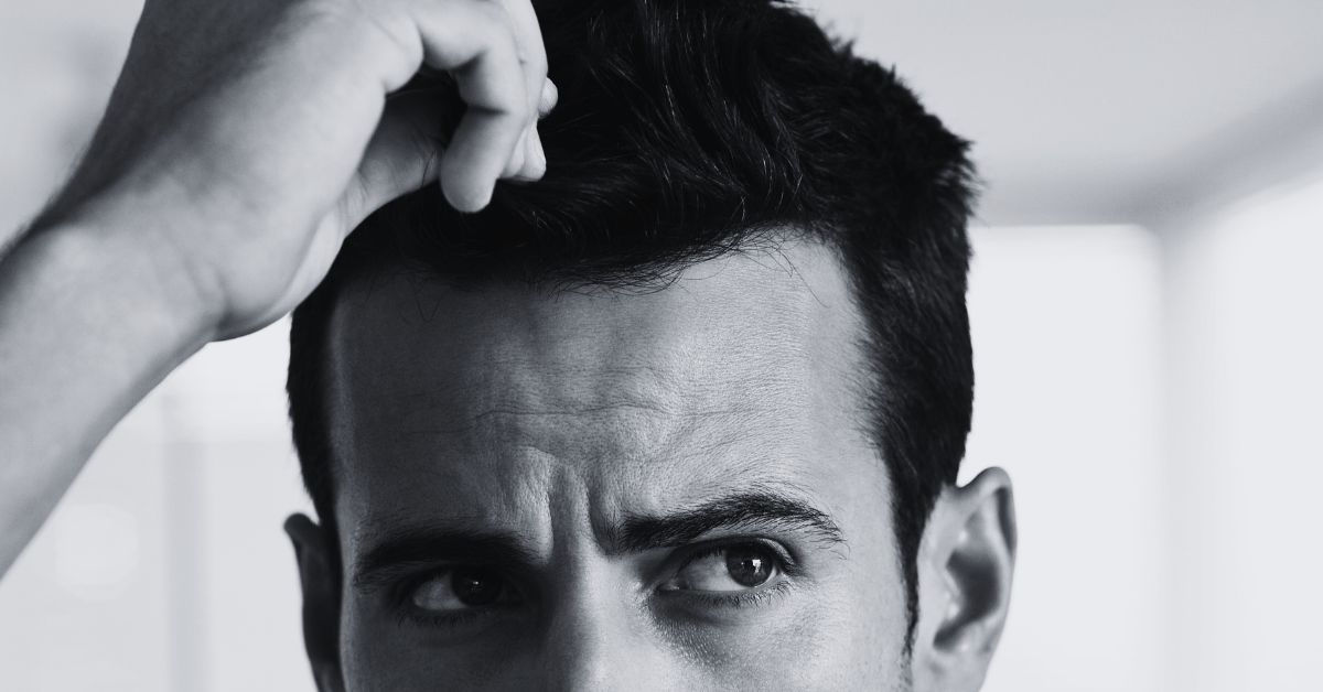 Precio de un implante de pelo