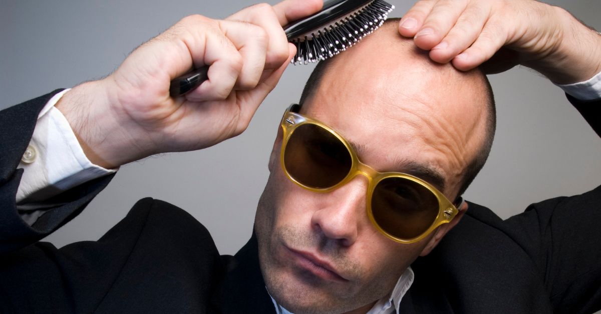 ¿Puede un calvo hacerse un trasplante de pelo?