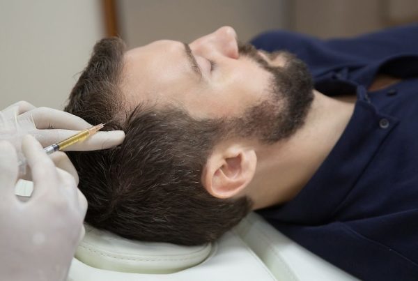 mesoterapia capilar hombres valencia