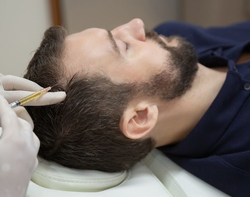 mesoterapia capilar hombres valencia