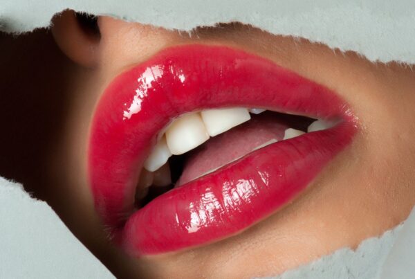 Labios Perfectos sin Cirugía en Valencia: Ácido Hialurónico para el Aumento de Labios