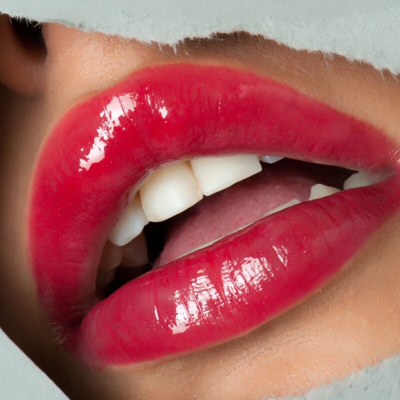 Labios Perfectos sin Cirugía en Valencia: Ácido Hialurónico para el Aumento de Labios
