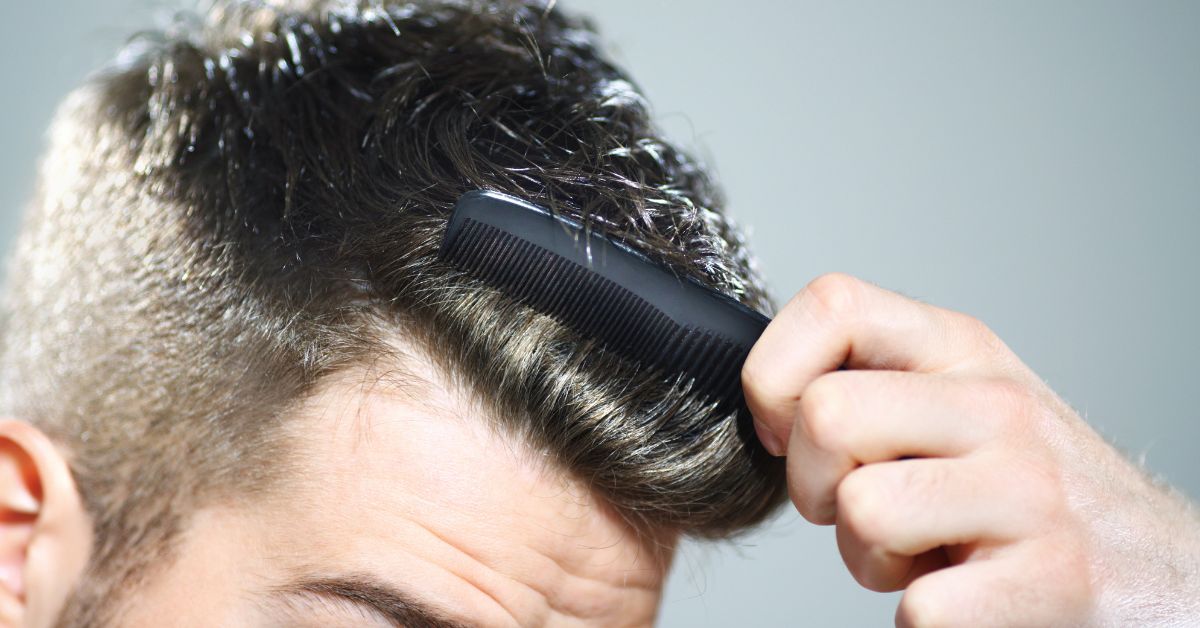 Implante de Pelo en Valencia: Todo lo que Tienes que Saber