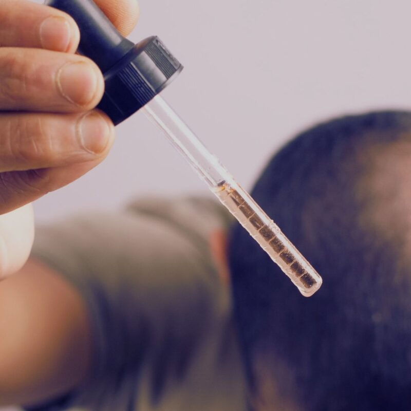 Minoxidil: El Tratamiento Que Puede Transformar Tu Cabello